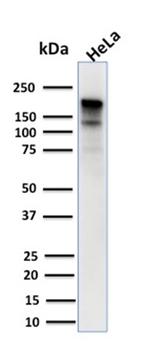 MSH6 (DNA Mismatch Repair Protein) Antibody in Western Blot (WB)