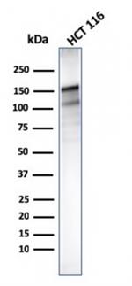 MSH6 (DNA Mismatch Repair Protein) Antibody in Western Blot (WB)