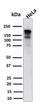 MSH6 (DNA Mismatch Repair Protein) Antibody in Western Blot (WB)