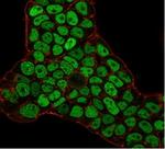 MSH6 (DNA Mismatch Repair Protein) Antibody in Immunocytochemistry (ICC/IF)