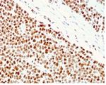 MSH6 (DNA Mismatch Repair Protein) Antibody in Immunohistochemistry (Paraffin) (IHC (P))