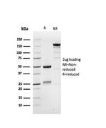 MSH6 (DNA Mismatch Repair Protein) Antibody in SDS-PAGE (SDS-PAGE)