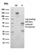 MSH6 (DNA Mismatch Repair Protein) Antibody in SDS-PAGE (SDS-PAGE)