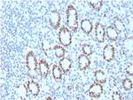 MSH6 (DNA Mismatch Repair Protein) Antibody in Immunohistochemistry (Paraffin) (IHC (P))