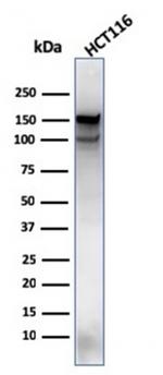 MSH6 (DNA Mismatch Repair Protein) Antibody in Western Blot (WB)