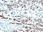 MSH6 (DNA Mismatch Repair Protein) Antibody in Immunohistochemistry (Paraffin) (IHC (P))