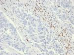 MSH6 (DNA Mismatch Repair Protein) Antibody in Immunohistochemistry (Paraffin) (IHC (P))