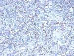 MSH6 (DNA Mismatch Repair Protein) Antibody in Immunohistochemistry (Paraffin) (IHC (P))