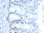 MSH6 (DNA Mismatch Repair Protein) Antibody in Immunohistochemistry (Paraffin) (IHC (P))