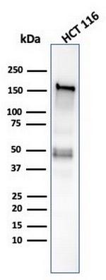 MSH6 (DNA Mismatch Repair Protein) Antibody in Western Blot (WB)