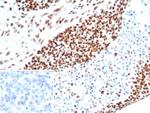 MSH6 (DNA Mismatch Repair Protein) Antibody in Immunohistochemistry (Paraffin) (IHC (P))