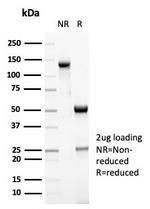 MSH6 (DNA Mismatch Repair Protein) Antibody in SDS-PAGE (SDS-PAGE)