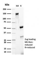 MSH6 (DNA Mismatch Repair Protein) Antibody in Immunoelectrophoresis (IE)