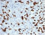 MSH6 (DNA Mismatch Repair Protein) Antibody in Immunohistochemistry (Paraffin) (IHC (P))