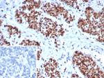 MSH6 (DNA Mismatch Repair Protein) Antibody in Immunohistochemistry (Paraffin) (IHC (P))