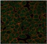 GTF2A1/ TFIIA (Transcription Factor) Antibody in Immunocytochemistry (ICC/IF)