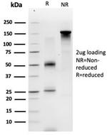 GTF2A1/ TFIIA (Transcription Factor) Antibody in SDS-PAGE (SDS-PAGE)