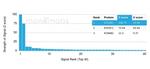 GTF2A1/ TFIIA (Transcription Factor) Antibody in Peptide array (ARRAY)