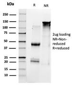 GTF2B/ TFIIB (Transcription Factor 2B) Antibody in SDS-PAGE (SDS-PAGE)