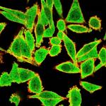 GTF2H2/BTF2/TFIIH Basal Transcription Factor Antibody in Immunocytochemistry (ICC/IF)