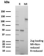 Beta-Parvin Antibody in SDS-PAGE (SDS-PAGE)