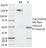 Granzyme B (NK/T-Cell Lymphoma Marker) Antibody in SDS-PAGE (SDS-PAGE)