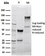 Granzyme B (NK/T-Cell Lymphoma Marker) Antibody in SDS-PAGE (SDS-PAGE)