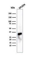 Granzyme B (NK/T-Cell Lymphoma Marker) Antibody in Western Blot (WB)