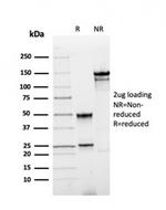 Annexin A1/ (Hairy Cell Leukemia Marker) Antibody in SDS-PAGE (SDS-PAGE)