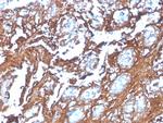 Annexin A1/ (Hairy Cell Leukemia Marker) Antibody in Immunohistochemistry (Paraffin) (IHC (P))