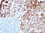 Annexin A1/(Hairy Cell Leukemia Marker) Antibody in Immunohistochemistry (Paraffin) (IHC (P))