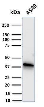 Annexin A1/ (Hairy Cell Leukemia Marker) Antibody in Western Blot (WB)