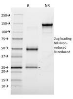 Annexin A1/ (Hairy Cell Leukemia Marker) Antibody in SDS-PAGE (SDS-PAGE)