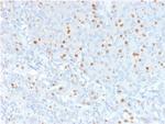 Annexin A1/ (Hairy Cell Leukemia Marker) Antibody in Immunohistochemistry (Paraffin) (IHC (P))