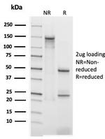 Annexin A1/ (Hairy Cell Leukemia Marker) Antibody in SDS-PAGE (SDS-PAGE)