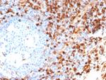 Annexin A1/(Hairy Cell Leukemia Marker) Antibody in Immunohistochemistry (Paraffin) (IHC (P))