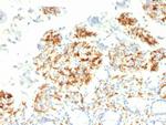 CD209/DC-SIGN (Pathogen Receptor on Dendritic Cells) Antibody in Immunohistochemistry (Paraffin) (IHC (P))