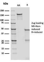 CD209/DC-SIGN (Pathogen Receptor on Dendritic Cells) Antibody in SDS-PAGE (SDS-PAGE)