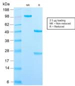 CD209/DC-SIGN (Pathogen Receptor on Dendritic Cells) Antibody in SDS-PAGE (SDS-PAGE)