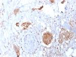 HIF1 alpha (Hypoxia-Inducible Factor 1-alpha) Antibody in Immunohistochemistry (Paraffin) (IHC (P))