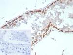 HIF1 alpha (Hypoxia-Inducible Factor 1-alpha) Antibody in Immunohistochemistry (Paraffin) (IHC (P))