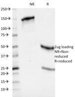 HLA-ABC (MHC I) Antibody in SDS-PAGE (SDS-PAGE)