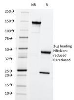 HLA-ABC (MHC I) Antibody in SDS-PAGE (SDS-PAGE)