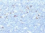 HLA-Aw32 and HLA-A25 (MHC I) Antibody in Immunohistochemistry (Paraffin) (IHC (P))