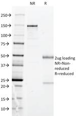 HLA-DP (MHC II) Antibody in SDS-PAGE (SDS-PAGE)