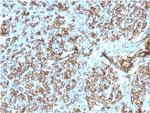 HLA-DP/-DQ/-DR (MHC II) Antibody in Immunohistochemistry (Paraffin) (IHC (P))