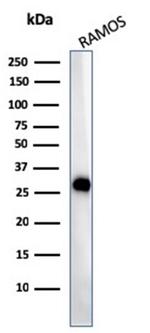 HLA-DP/-DQ/-DR (MHC II) Antibody in Western Blot (WB)