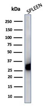 HLA-DP/-DQ/-DR (MHC II) Antibody in Western Blot (WB)