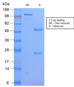 HLA-DP (MHC II) Antibody in SDS-PAGE (SDS-PAGE)