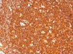 HLA-DR (MHC II) Antibody in Immunohistochemistry (Paraffin) (IHC (P))